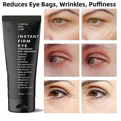 Eye Care Cream (70% OFF)